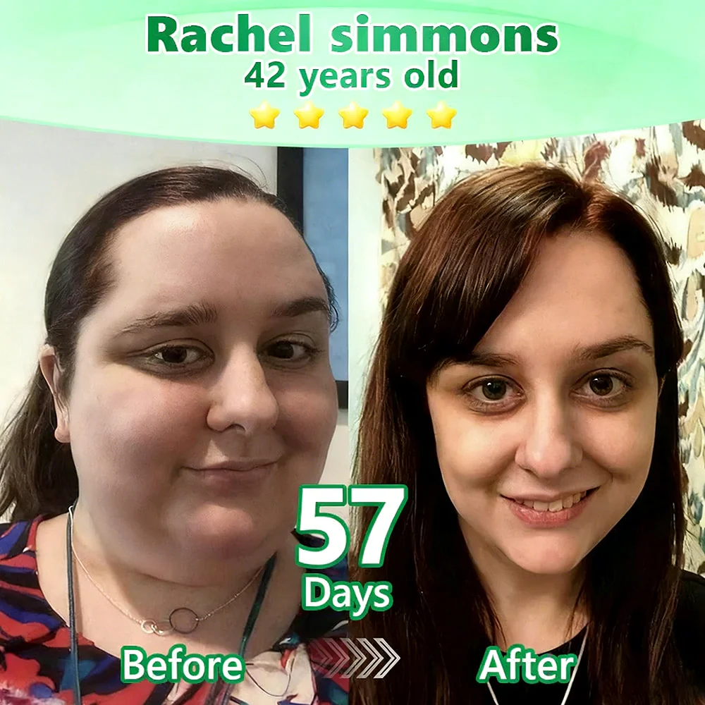 🇺🇸 𝑶𝒇𝒇𝒊𝒄𝒊𝒂𝒍 𝑺𝒕𝒐𝒓𝒆 🐱  | 🌿GFOUK®𝑴𝒐𝒓𝒊𝒏𝒈𝗮 · 𝗕𝗲𝗿𝗯𝗲𝗿𝙞𝙣𝙚 × 𝙉𝘼𝐃+ 𝟏𝟎-𝐢𝐧-𝟏 𝗔𝗱𝘃𝗮𝗻𝗰𝙚𝙙 𝙉𝙖𝙣𝙤 𝙈𝙞𝙘𝙧𝙤𝙣𝙚𝙚𝐝𝐥𝐞 𝐏𝐚𝐭𝙘𝙝🇺🇸(𝐉𝐮𝐬𝐭 𝐨𝐧𝐜𝐞 𝐚 𝐝𝐚𝐲, 𝐯𝐢𝐬𝐢𝐛𝐥𝐞 𝐜𝐡𝐚𝐧𝐠𝐞𝐬 𝐢𝐧 𝟕 𝐝𝐚𝐲𝐬） ✅ 𝐅𝐨𝐫 𝐨𝐛𝐞𝐬𝐢𝐭𝐲, 🅛🅞🅞🅢🅔 🅢🅚🅘🅝,𝐝𝐢𝐚𝐛𝐞𝐭𝐞𝐬, 𝐬𝐥𝐞𝐞𝐩 𝐚𝐩𝐧𝐞𝐚, 𝐣𝐨𝐢𝐧𝐭 𝐢𝐬𝐬𝐮𝐞𝐬, 𝐚𝐧𝐝 𝐦𝐨𝐫𝐞 - Image 8